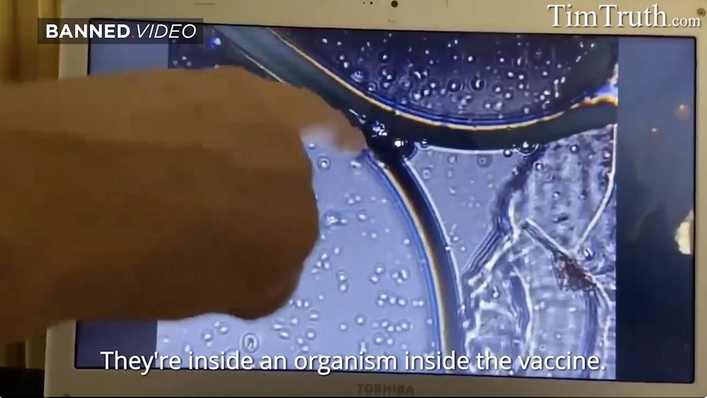 DISTURBING! Pfizer Vaccine Zoomed w Microscope! Are Living Cells Organisms Mixed In!